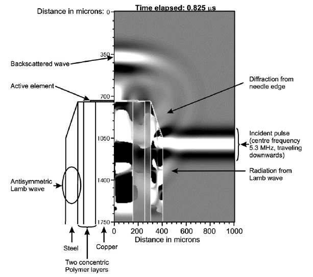 annotated needle